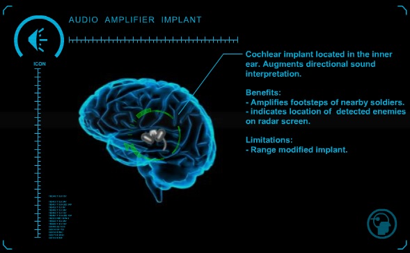 Audio Amplifier Implant